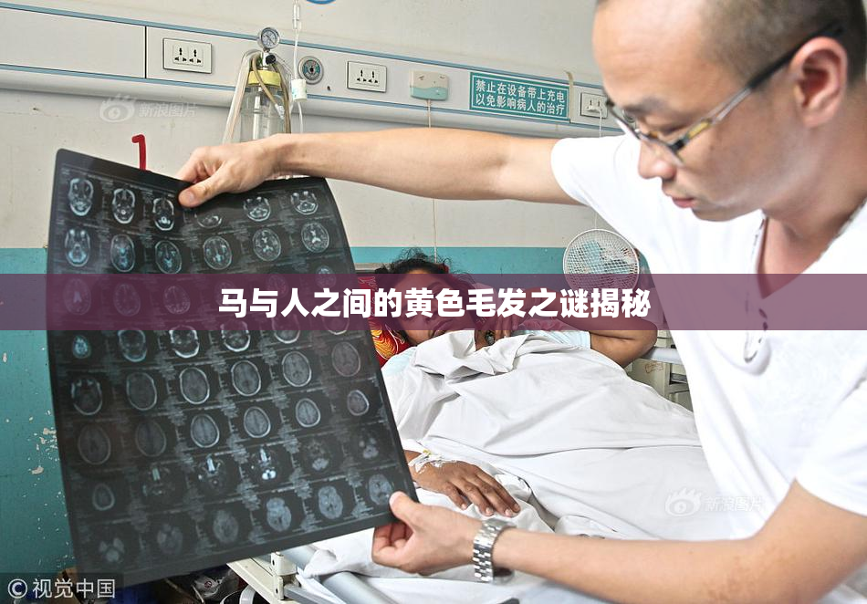 马与人之间的黄色毛发之谜揭秘