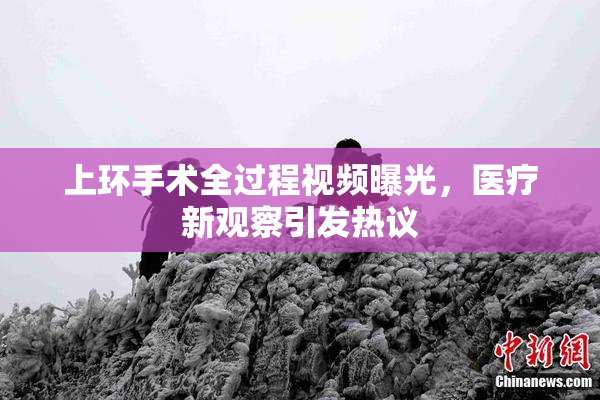 上环手术全过程视频曝光，医疗新观察引发热议