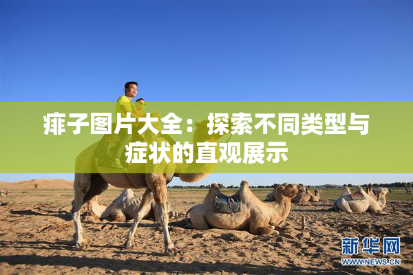 痱子图片大全：探索不同类型与症状的直观展示