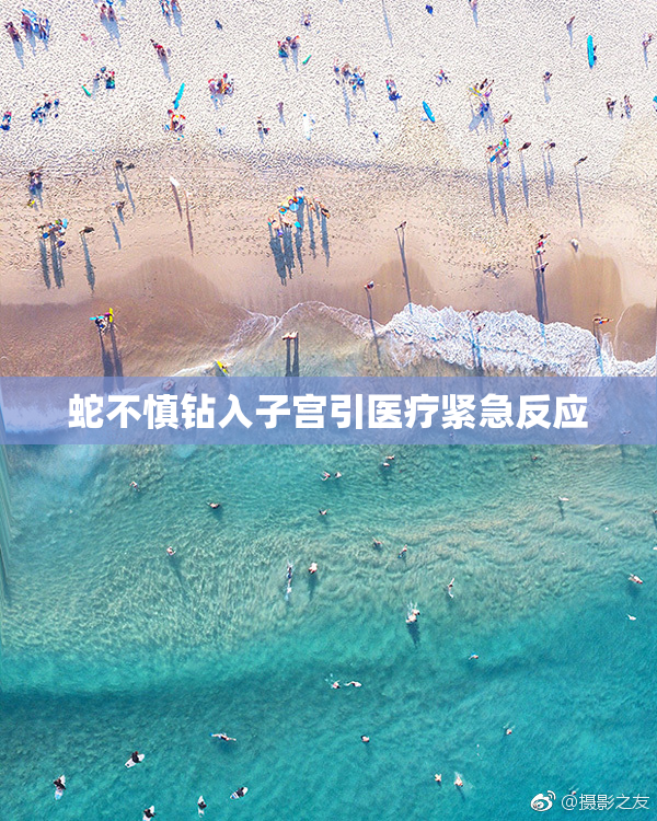 蛇不慎钻入子宫引医疗紧急反应