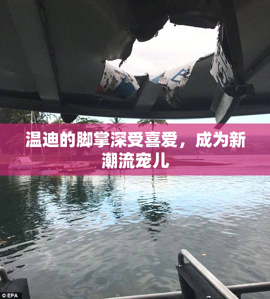 温迪的脚掌深受喜爱，成为新潮流宠儿