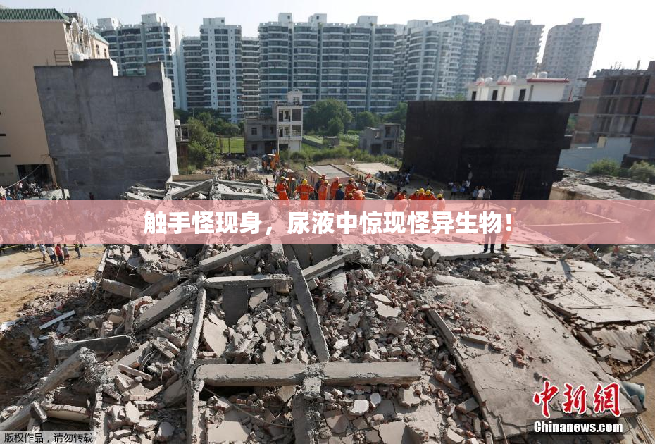 触手怪现身，尿液中惊现怪异生物！