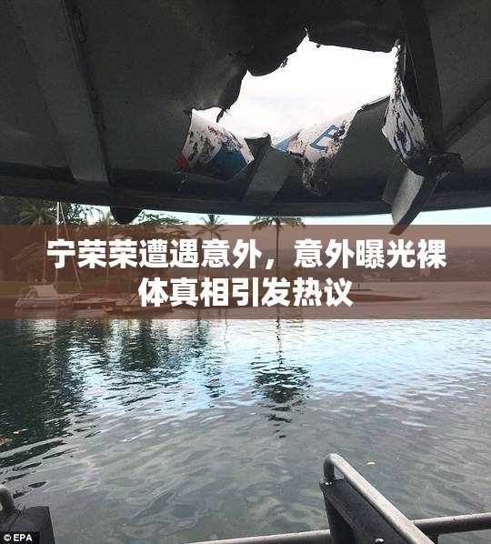 宁荣荣遭遇意外，意外曝光裸体真相引发热议