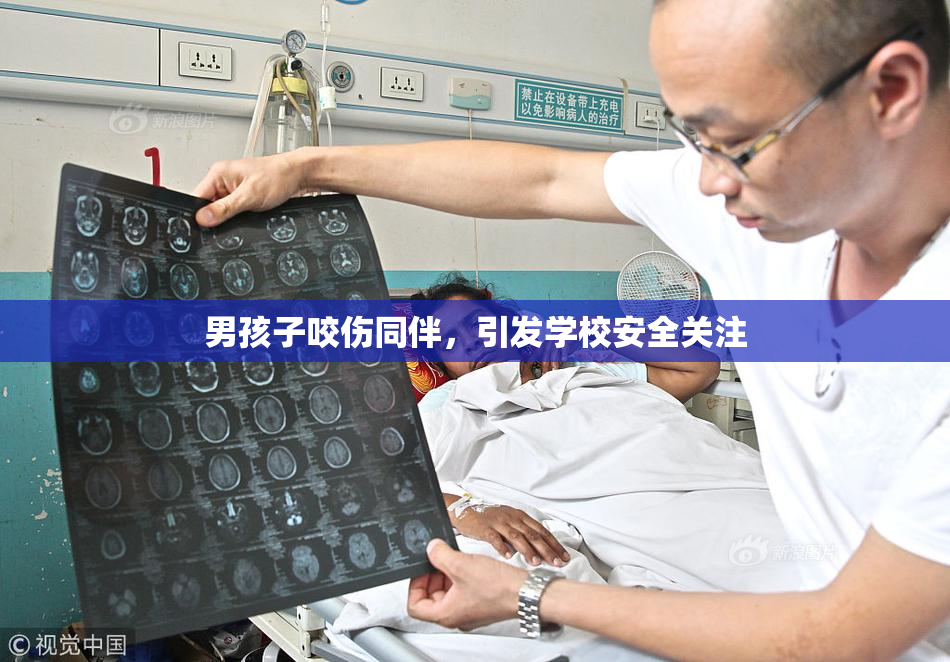 男孩子咬伤同伴，引发学校安全关注