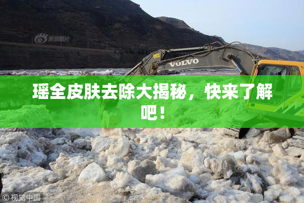 瑶全皮肤去除大揭秘，快来了解吧！