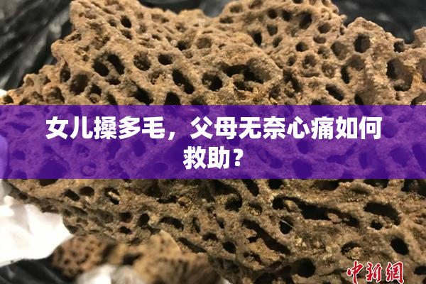 女儿搡多毛，父母无奈心痛如何救助？