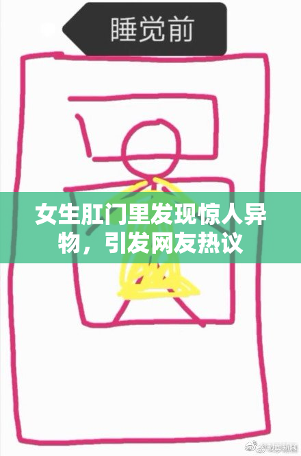 女生肛门里发现惊人异物，引发网友热议