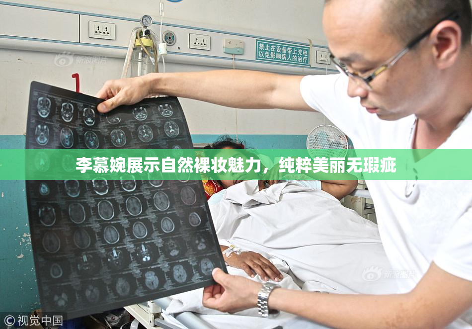 李慕婉展示自然裸妆魅力，纯粹美丽无瑕疵