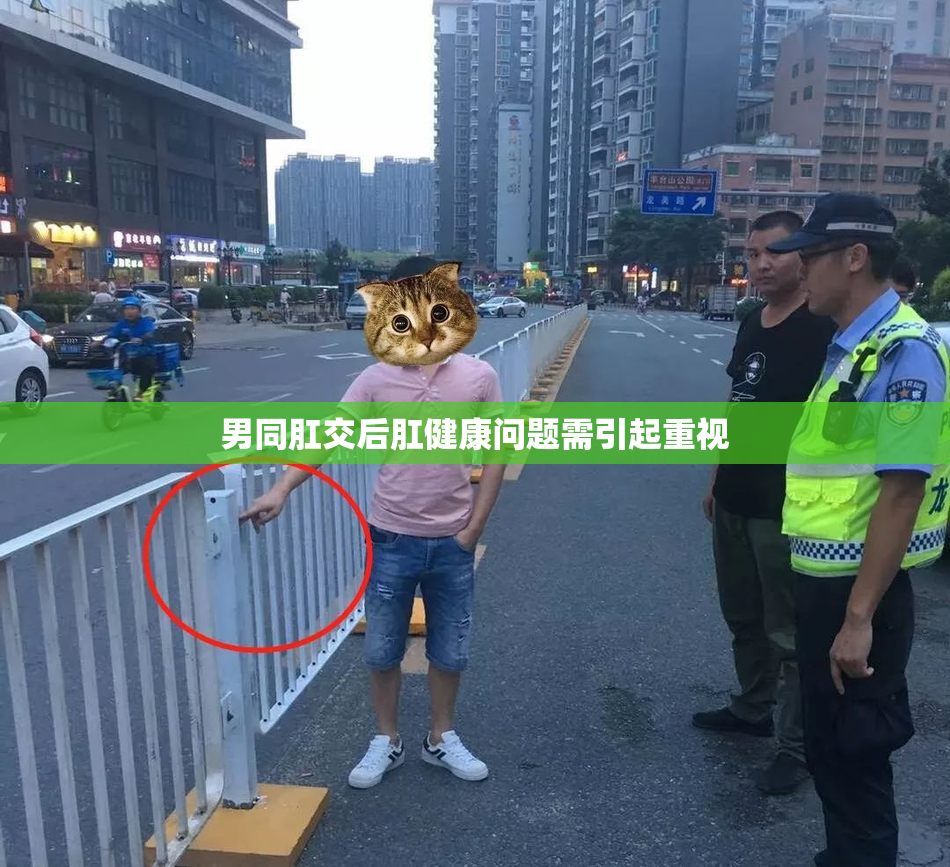 男同肛交后肛健康问题需引起重视