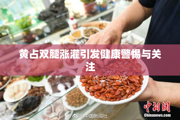黄占双腿涨灌引发健康警惕与关注